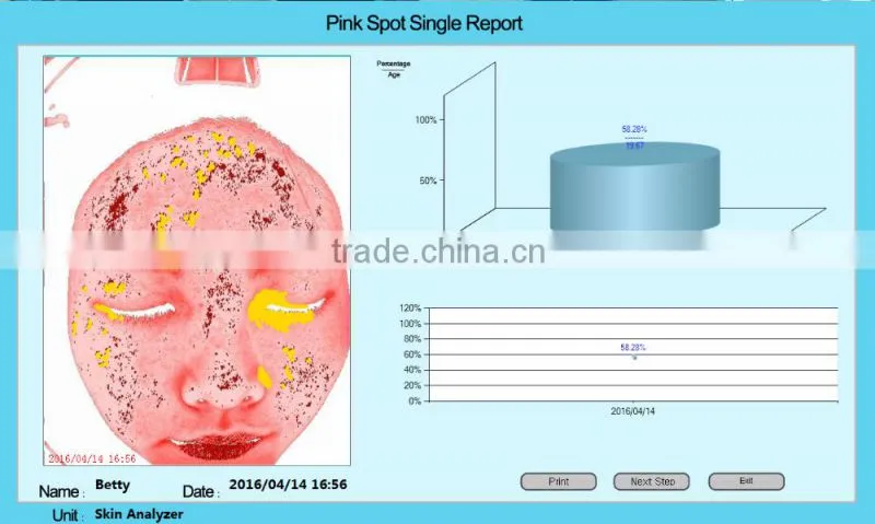 best magic 3d facial skin analyzer with camera beauty salon machine LD6021C