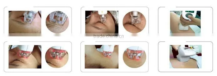 2014 hot selling cellulite remove weight ultrasonic cavitation vacuum slimming machine