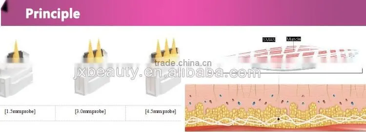 hifu/high intensity focused ultrasound/hifu machine