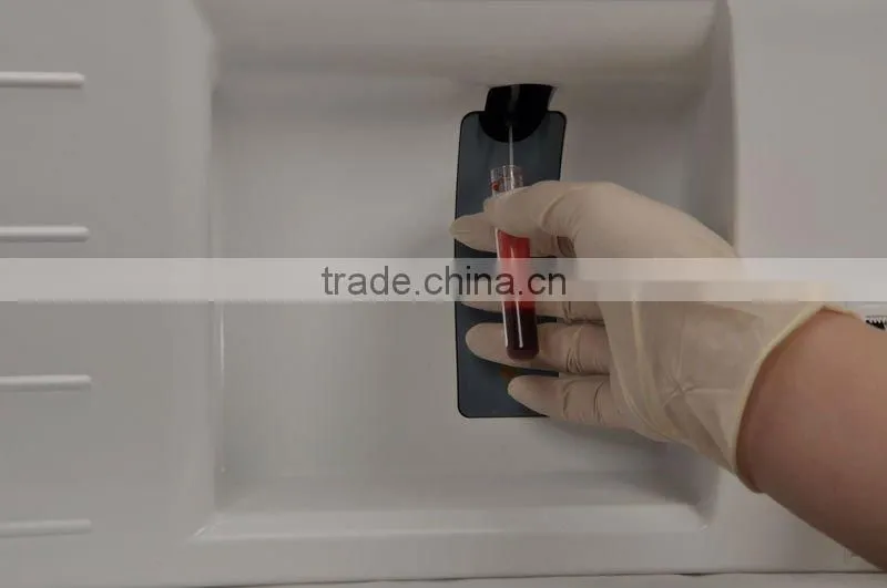 Clinical Test Equipment Hematology