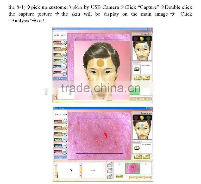 Wholesale skin analyzer machine