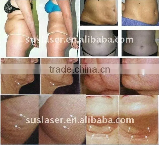 2013 Cavitation RF Ultrasonic machine S80C ISO/CE cavitation rf body sculpting