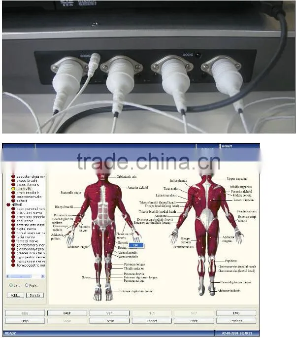 Professional EMG EP Systems Electromyography myoelectricity connecting computer for Neurology with CE ISO