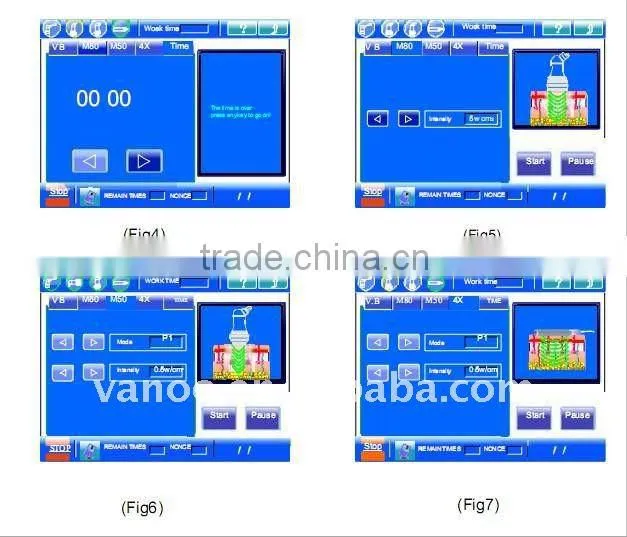 vacuum cavitation body slimming equipment