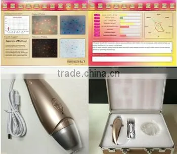 AYJ-J016 skin ance blackhead wrinkle microscope