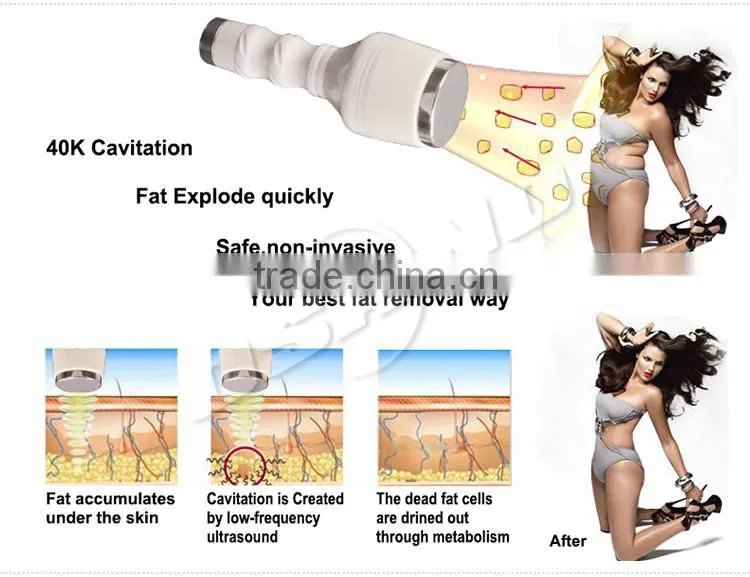 Weight Loss Multipolar RF Radiofrequency Vacuum beauty salon machine