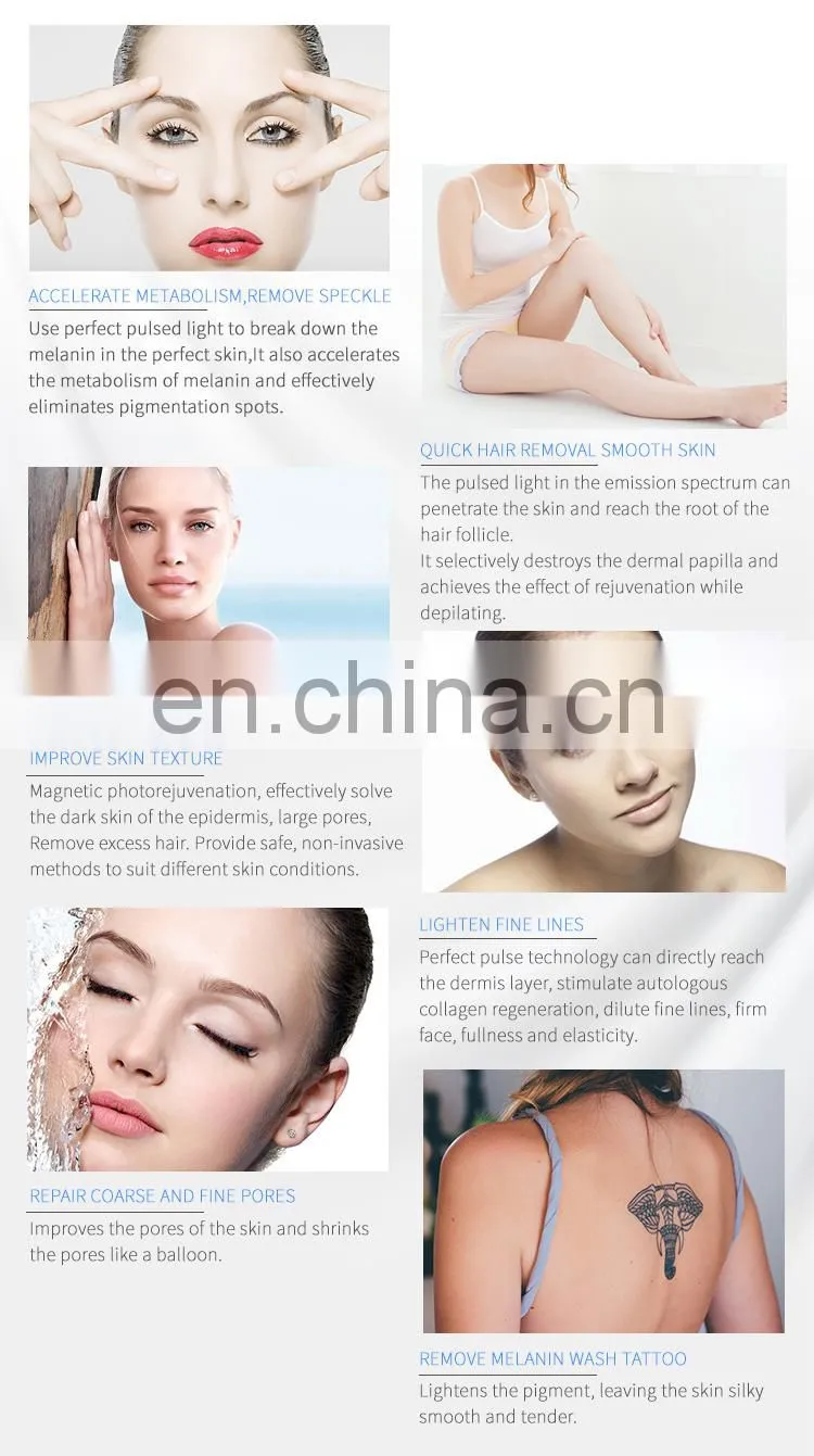 price qswitch laser opt hair tattoo pigmentation removal machine