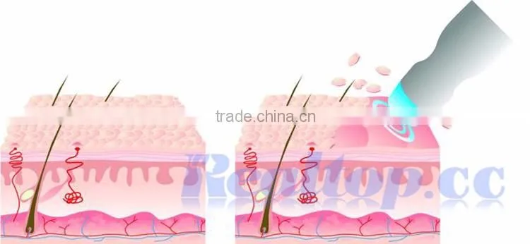 HOT!!! Portable Diamond Microdermabrasion Machine for Skin Rejuvenation