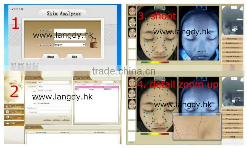 computer software skin analysis system acne wrinkle spot pore analyzer device