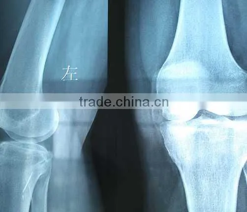 Imaging medical ray film,digital x-ray cr,fuji dry film with CE sale from manufacturer