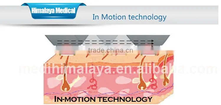 salon equipment 808nm diode laser hair removal