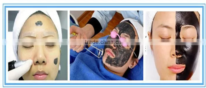 Professional Q switch nd yag laser tattoo removal system