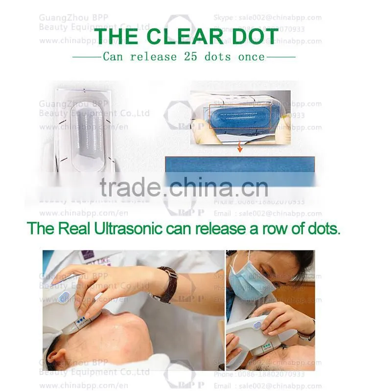 2016 new technology medical hifu machine for face lift and wrinkle removal