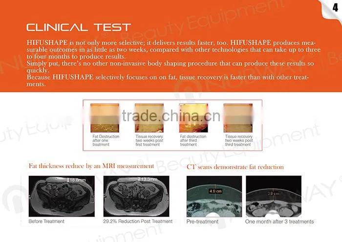 Newest slimming technology HIFUSHAPE body slimming arm liposuction