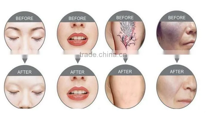hotsell professional led light therapy mask led skin rejuvenation mask