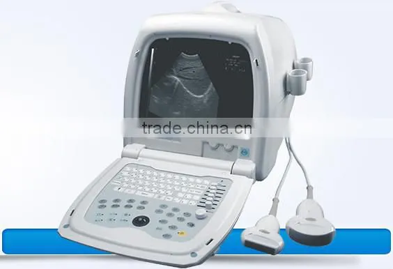 2015 Most Popular ultrasonic equipment