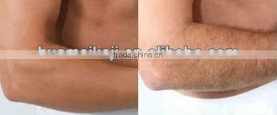 808nm diode laser machine medical intrument