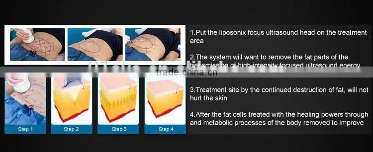 2016 slimming machine liposonix hifu machine