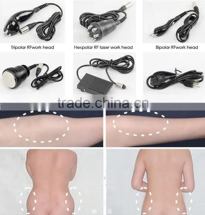 fast losing fat Ultrasonic Cavitation RF Radio Frequency salon use slimming Machine price