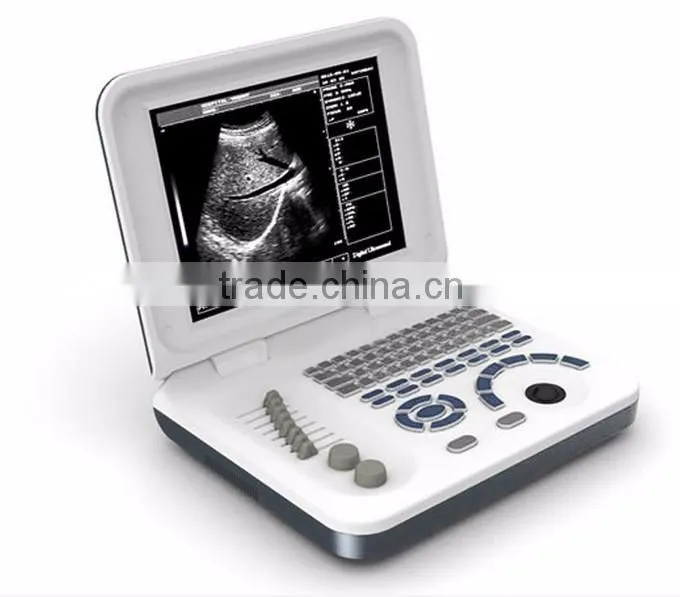 laptop vet ultrasound scanner/color doppler