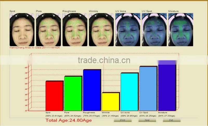 skin diagnosis machine,skin testing equipment, skin analyzer