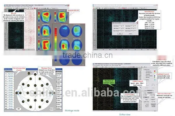Best china optical instrument KT88-2400 Digital EEG And Mapping System