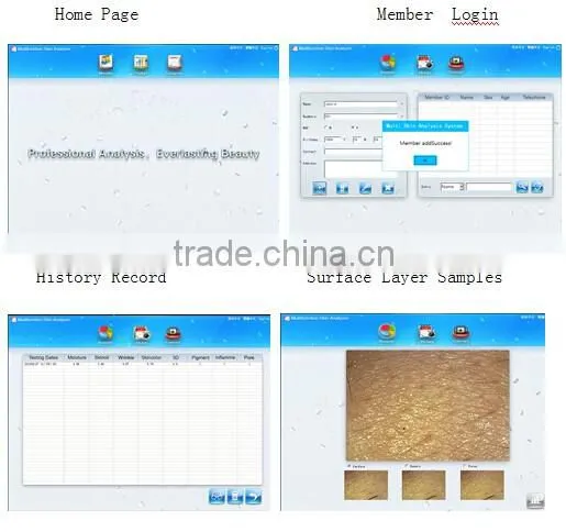Professional 5 MP smart uv skin analyzer/ skin test machine