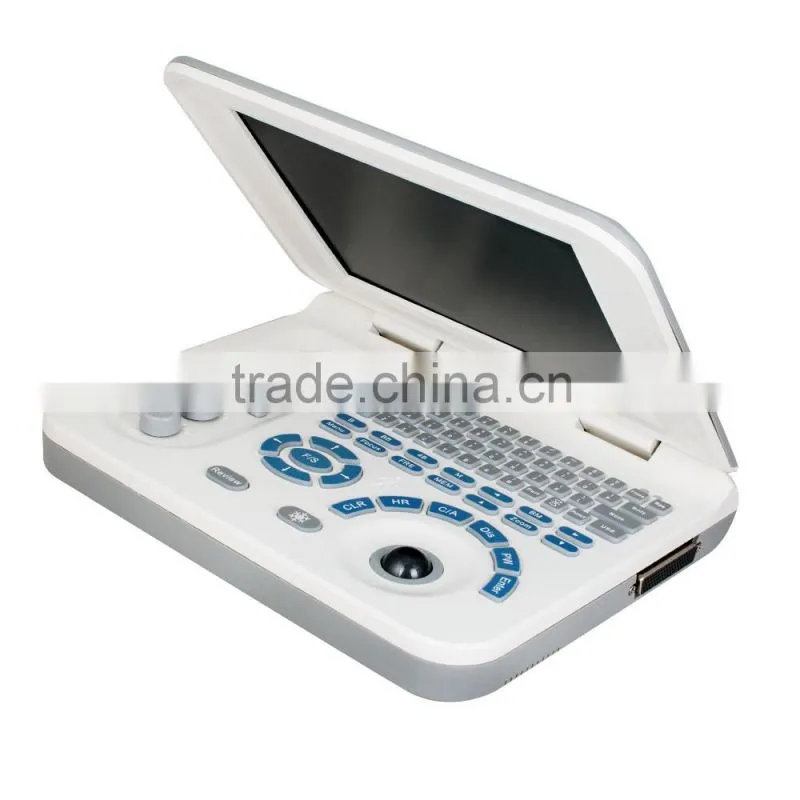 Carejoy laptop Ultrasound Machine Ultrasound Scanner with convex probe RUS-9000F2 by CE ISO approved