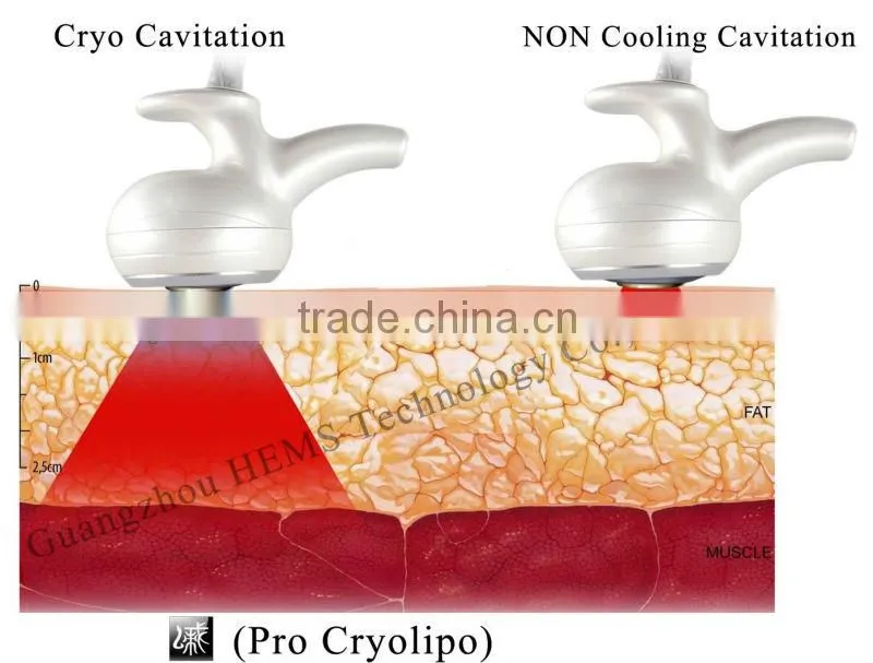 Body Liposlim ultrasound fat cavitation machine-Pro Cryolipo