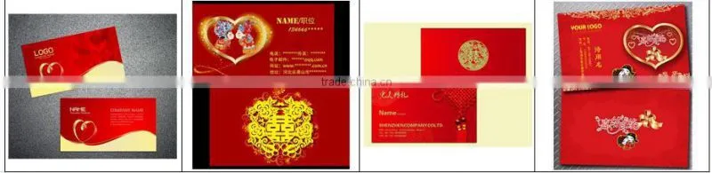 professional big direct factory high quality for screen printing supply