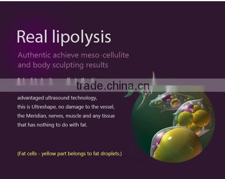 2016 ultrashape hifu body slimming machine / liposonic machine / ultrasonic ultrasound liposuction equipment for weight loss