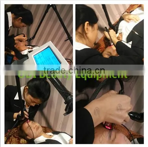High qualtiy strechmark removal fractional co2 laser machine
