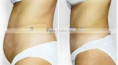 CE Cavitation slimming machine Rf freezing cavitation weight loss machine