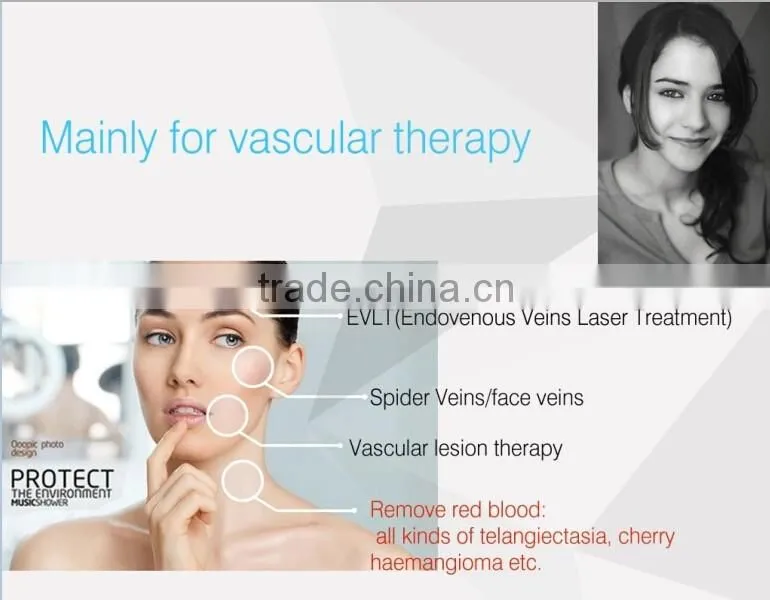 Vascular Removal Spider Vein removal 980nm medical diode laser 16W
