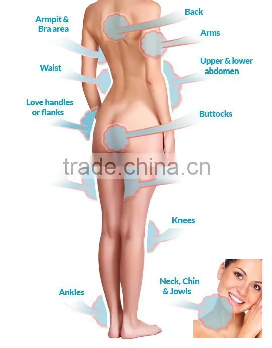 2015 New Arrival 808nm Diode Laser hair removal equipment DL-A1