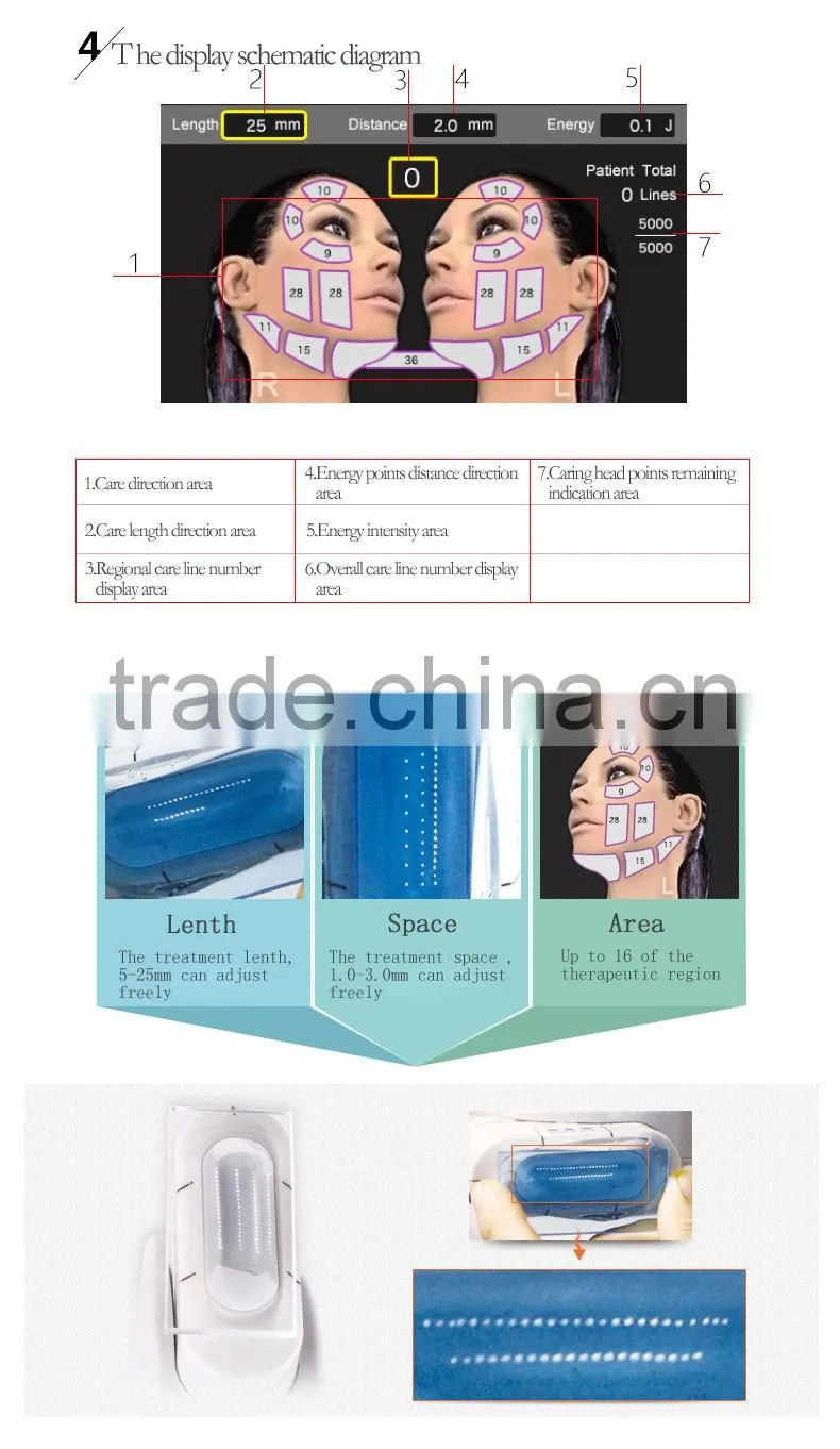 2016 Professional HIFU High Intensity Focused Ultrasound Hifu Machine for Face Lift