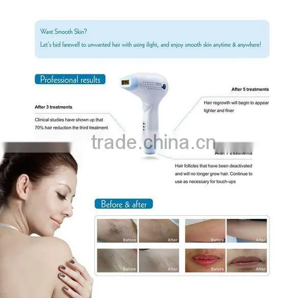 DEESS hair removal diode laser home hair removal wrinkle remover