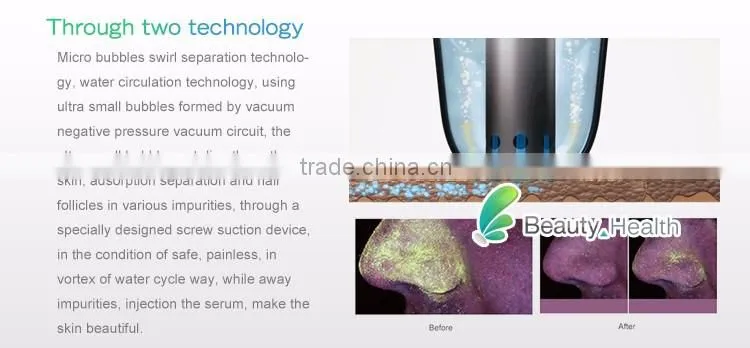 Negative pressure ionic face cleaning machine washing pores machine