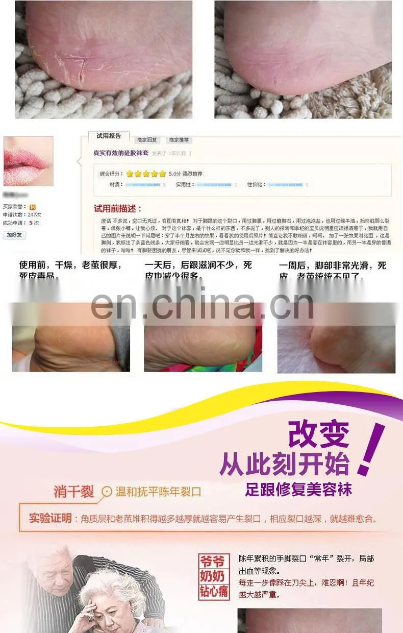 5-Toe Moisturizing Gel Socks#YG-06