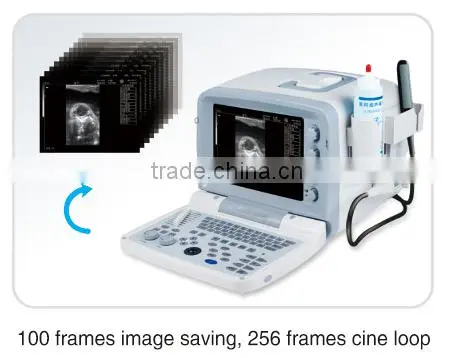 FN200V Full digital B model veterinary portable ultrasound scanner