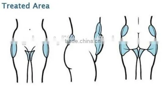 Portable crioterapia machine