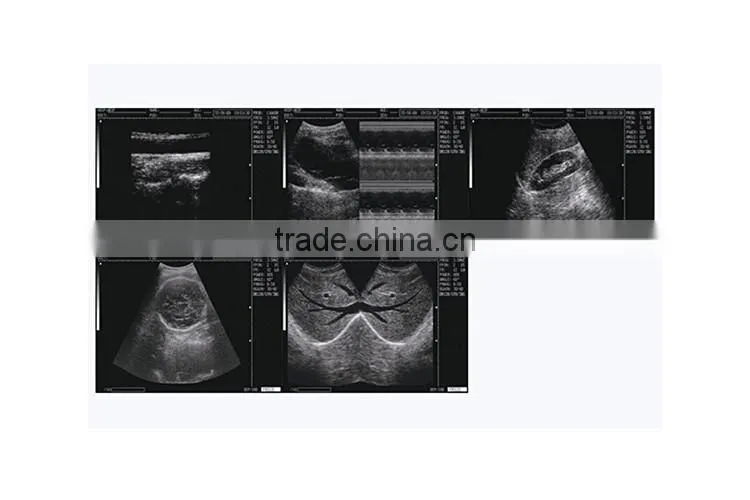 China beijing 10.7 inch color LCD 2B Ultrasound Imaging System laptop ultrasound scanner with CE ISO Approved