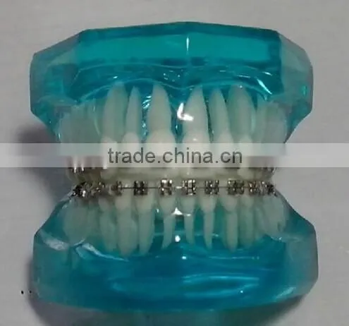 dental manufacturer Hot-sell ceramic red teeth orthodontic model