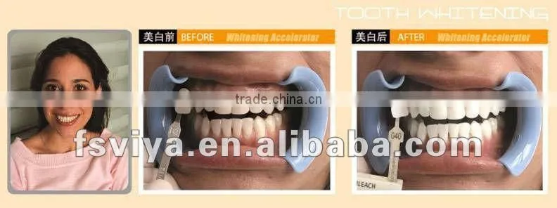 VY-EL003 Hot sale teeth whitening machine salon teeth whitening kit