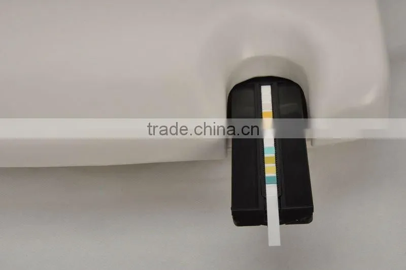 Semi-automated Urine Analysis