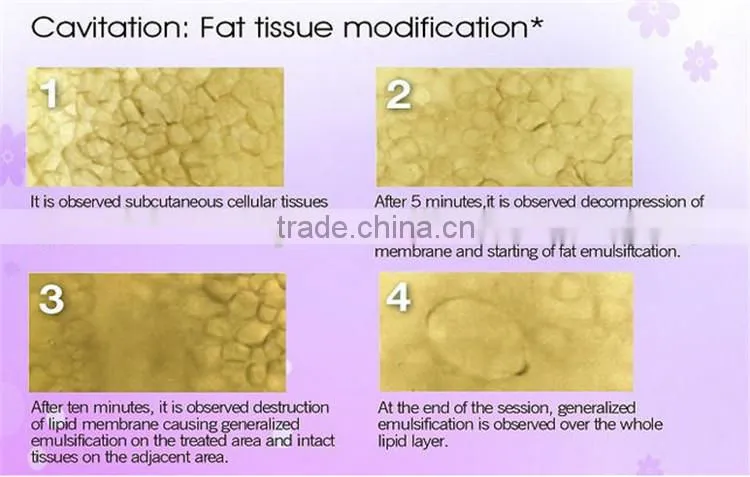 (CE) keywords cavitation rf machine wrinkle remove skin lifting rf and bio infrared skin tightening machine