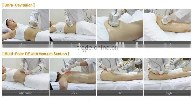 2012 Cryotherapy Freeze fat Slimming Equipment