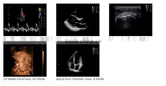 CE ISO approved medical 15 inch LCD Monitor 3D 4D trolley color doppler ultrasound scanner