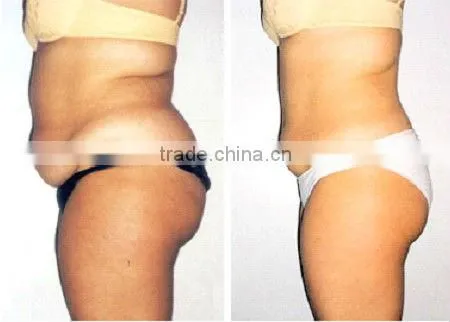 Fast slimming portable ultrasound cavitation&rf slimming machine-F013 for home use