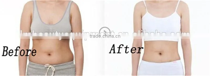 body shaper slimming machine electric slimming vibrator